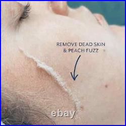 Dermaflash Luxe Facial Exfoliation Navy (BNIB) + 4 x Exfoliating Edges As Gift