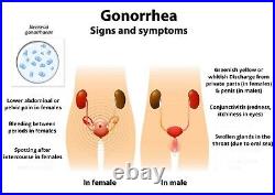 Gonorrhea Men & Women Antibacterial Anti Inflammatory Made In USA